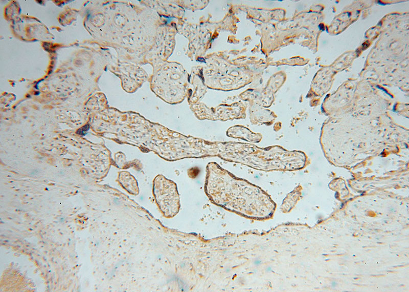 Immunohistochemical of paraffin-embedded human placenta using Catalog No:116295(TRIB2 antibody) at dilution of 1:50 (under 10x lens)