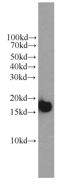 HeLa cells were subjected to SDS PAGE followed by western blot with Catalog No:117311(COXIV antibody) at dilution of 1:2000