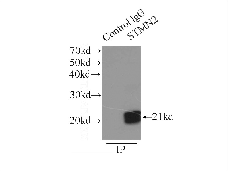 IP Result of anti-STMN2 (IP:Catalog No:115726, 3ug; Detection:Catalog No:115726 1:1000) with mouse brain tissue lysate 9500ug.