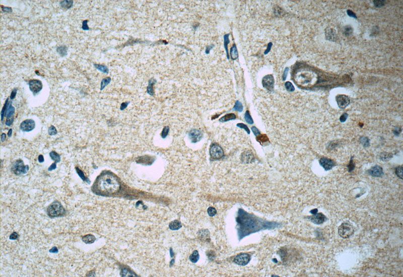 Immunohistochemistry of paraffin-embedded human brain tissue slide using Catalog No:107359(KCNMB4 Antibody) at dilution of 1:50 (under 40x lens)