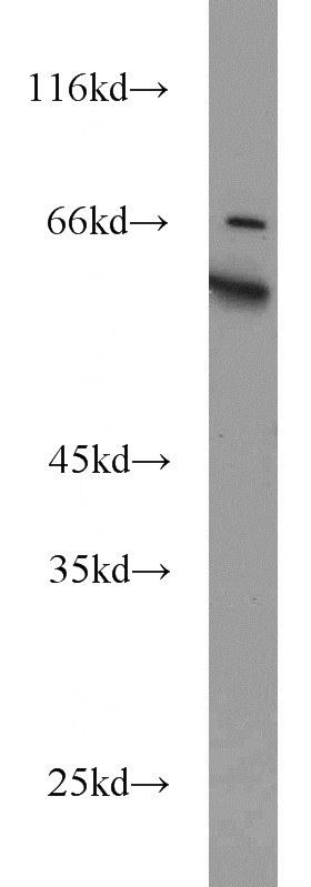 PC-3 cells were subjected to SDS PAGE followed by western blot with Catalog No:112089(KLHL12 antibody) at dilution of 1:1000