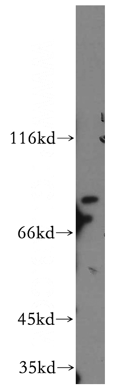 mouse testis tissue were subjected to SDS PAGE followed by western blot with Catalog No:112481(MARK4 antibody) at dilution of 1:500