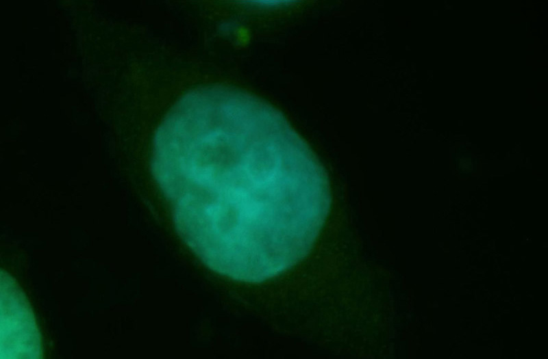 Immunofluorescent analysis of Hela cells, using TSPYL2 antibody Catalog No:109089 at 1:50 dilution and FITC-labeled donkey anti-rabbit IgG (green). Blue pseudocolor = DAPI (fluorescent DNA dye).