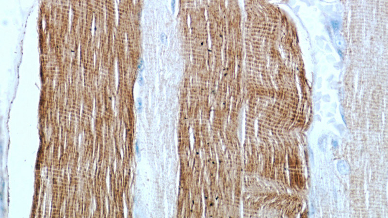 Immunohistochemical of paraffin-embedded human skeletal muscle using Catalog No:112932(MYH2 antibody) at dilution of 1:50 (under 40x lens)