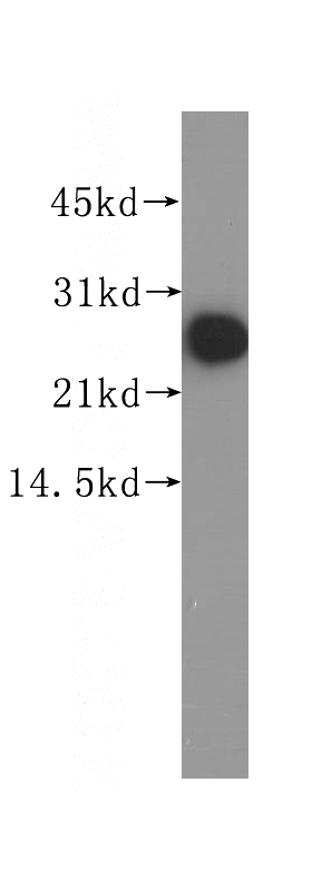 human brain tissue were subjected to SDS PAGE followed by western blot with Catalog No:114438(RAB39B antibody) at dilution of 1:200