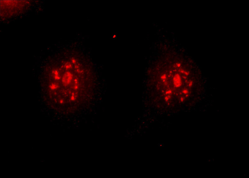 Immunofluorescent analysis of HeLa cells using Catalog No:110002(DMC1 Antibody) at dilution of 1:50 and Rhodamine-Goat anti-Rabbit IgG
