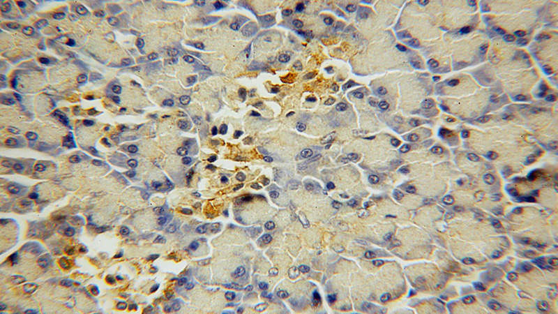Immunohistochemical of paraffin-embedded human pancreas using Catalog No:107841(AGXT2L2 antibody) at dilution of 1:50 (under 40x lens)