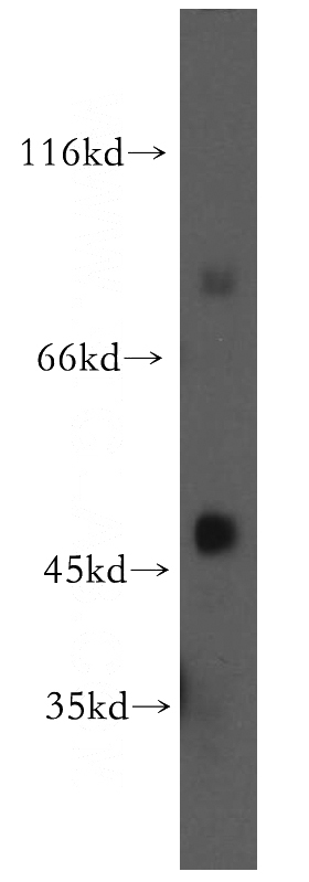 human kidney tissue were subjected to SDS PAGE followed by western blot with Catalog No:116017(TGDS antibody) at dilution of 1:300