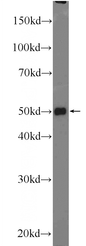 mouse liver tissue were subjected to SDS PAGE followed by western blot with Catalog No:116388(TTC7B Antibody) at dilution of 1:600