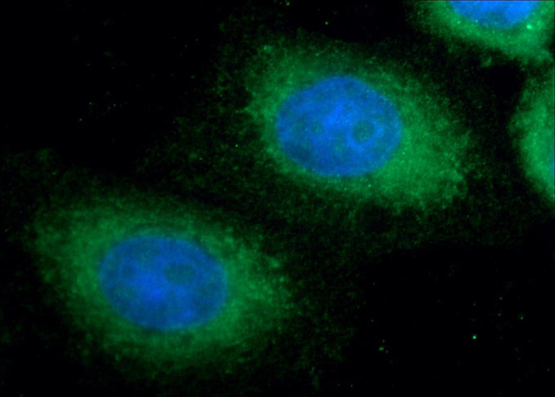 Immunofluorescent analysis of HepG2 cells using Catalog No:108077(ANKRD49 Antibody) at dilution of 1:25 and Alexa Fluor 488-congugated AffiniPure Goat Anti-Rabbit IgG(H+L)