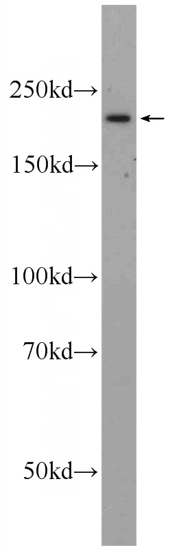 HeLa cells were subjected to SDS PAGE followed by western blot with Catalog No:115384(SMCHD1 Antibody) at dilution of 1:600