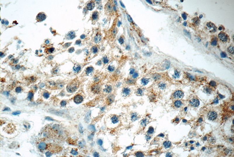 Immunohistochemistry of paraffin-embedded human testis tissue slide using Catalog No:116158(TNRC4 Antibody) at dilution of 1:50 (under 40x lens)