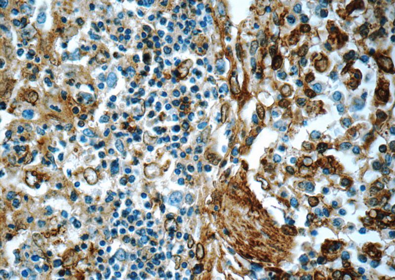 Immunohistochemistry of paraffin-embedded human spleen tissue slide using Catalog No:108096(ANXA5 Antibody) at dilution of 1:400 (under 40x lens)