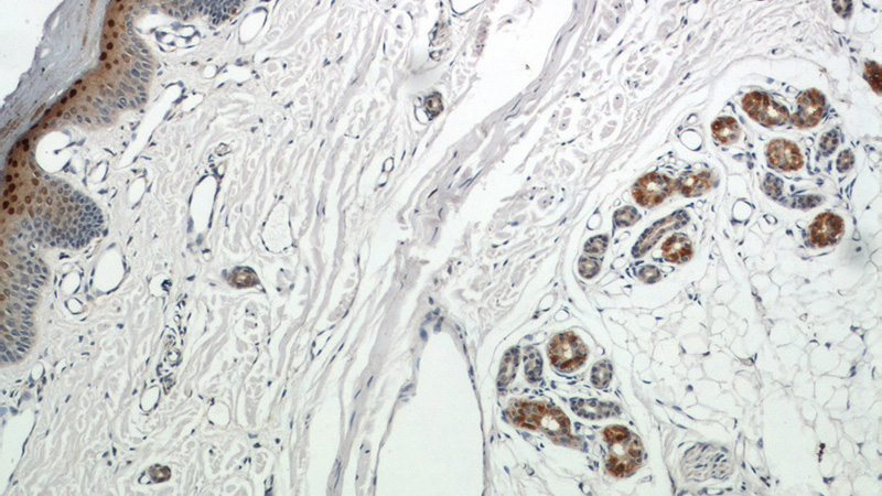 Immunohistochemical of paraffin-embedded human skin using Catalog No:112079(SP6 antibody) at dilution of 1:100 (under 10x lens)