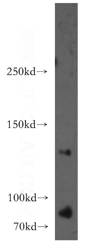 HT-1080 cells were subjected to SDS PAGE followed by western blot with Catalog No:115236(SIPA1 antibody) at dilution of 1:300