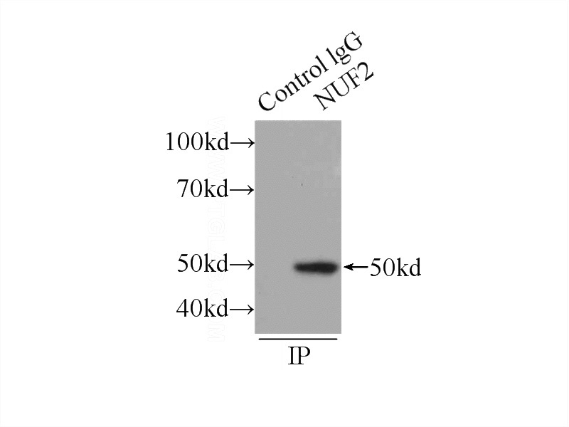 IP Result of anti-NUF2 (IP:Catalog No:113365, 3ug; Detection:Catalog No:113365 1:500) with HEK-293 cells lysate 1760ug.