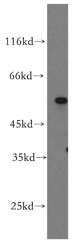 human testis tissue were subjected to SDS PAGE followed by western blot with Catalog No:113752(PCSK4 antibody) at dilution of 1:1000