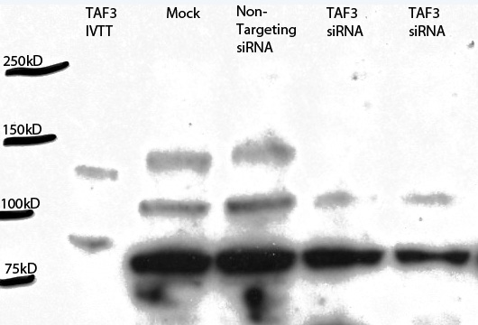 WB results of TAF3 (Catalog No:115986) with siRNA sample. (140 kDa band absent in siRNA sample)
