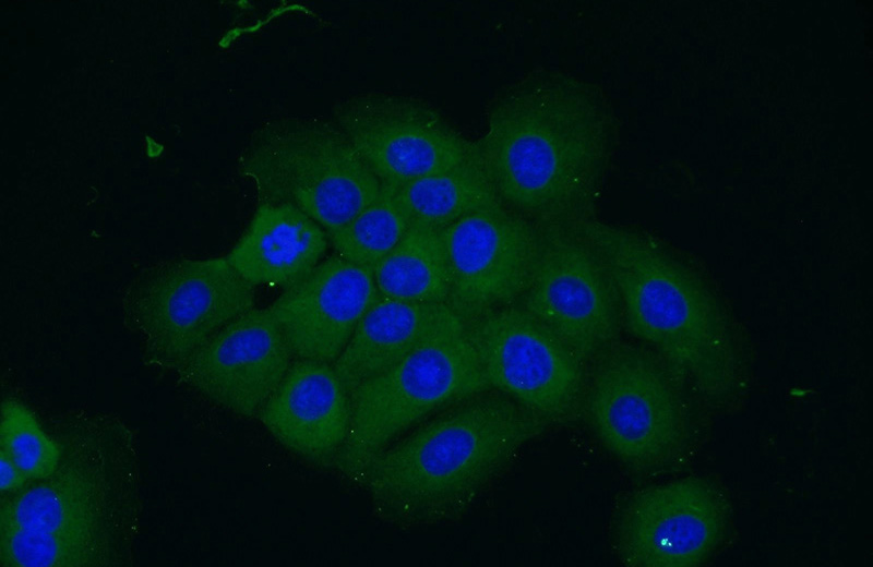 Immunofluorescent analysis of A431 cells using Catalog No:116792(VPS4B Antibody) at dilution of 1:25 and Alexa Fluor 488-congugated AffiniPure Goat Anti-Rabbit IgG(H+L)