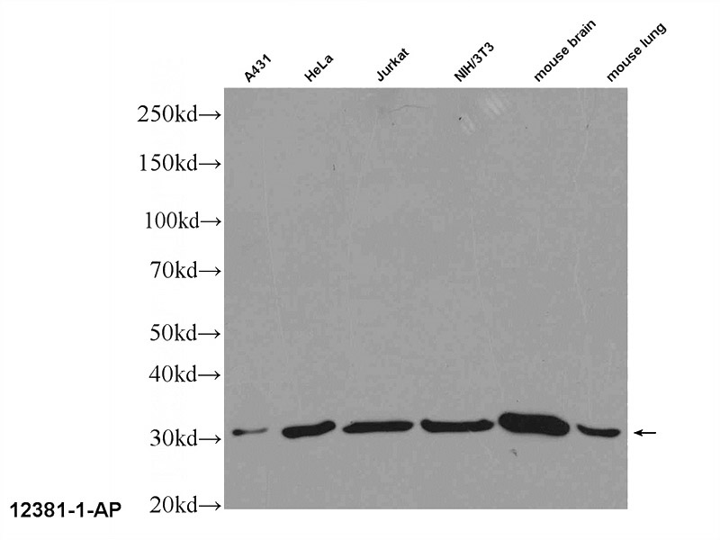 A431 cells were subjected to SDS PAGE followed by western blot with Catalog No:107660(14 3 3GAMMA Antibody) at dilution of 1:600