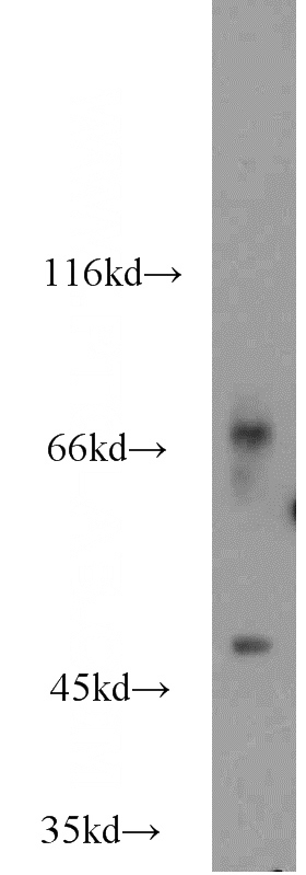 HEK-293 cells were subjected to SDS PAGE followed by western blot with Catalog No:109190(CERCAM antibody) at dilution of 1:1500