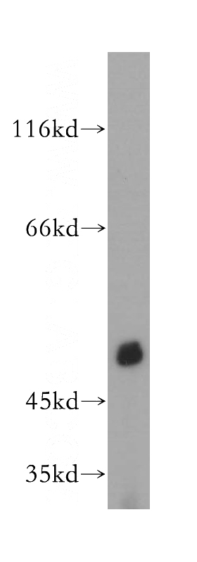 HeLa cells were subjected to SDS PAGE followed by western blot with Catalog No:113669(PDE7B antibody) at dilution of 1:1000