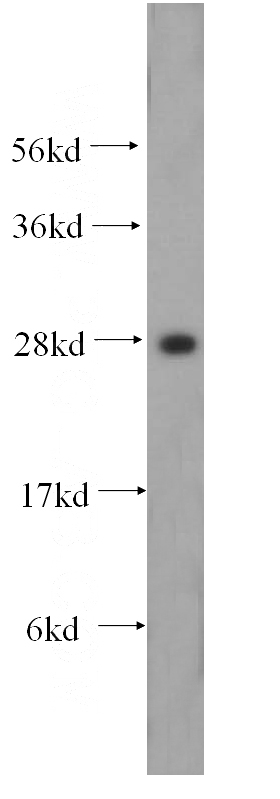 A549 cells were subjected to SDS PAGE followed by western blot with Catalog No:111441(HOXD4 antibody) at dilution of 1:1000