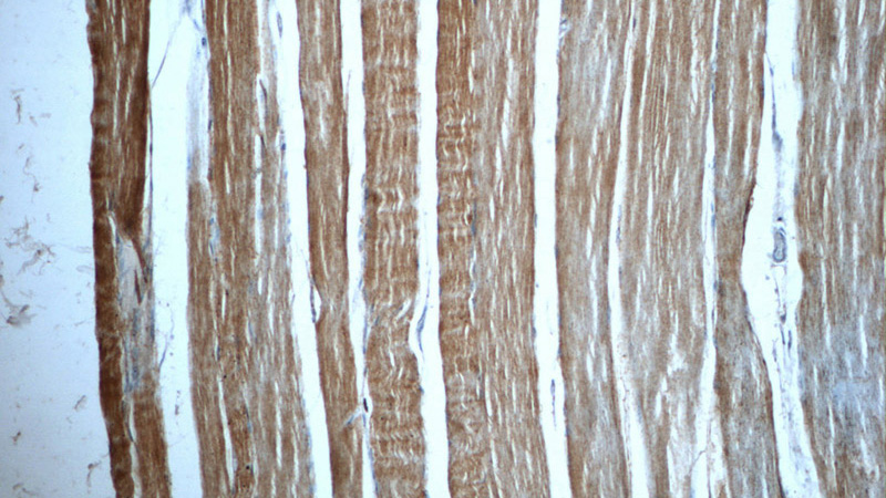 Immunohistochemistry of paraffin-embedded human skeletal muscle tissue slide using Catalog No:116155(TNNT3 Antibody) at dilution of 1:50 (under 10x lens)