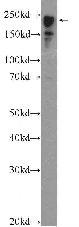 rat heart tissue were subjected to SDS PAGE followed by western blot with Catalog No:112935(MYH6 Antibody) at dilution of 1:5000