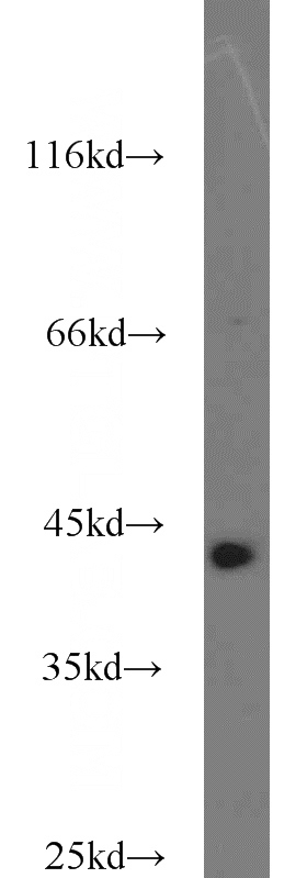 HeLa cells were subjected to SDS PAGE followed by western blot with Catalog No:114496(RABEPK antibody) at dilution of 1:1000