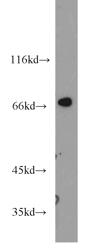 human heart tissue were subjected to SDS PAGE followed by western blot with Catalog No:112255(KCNA2 antibody) at dilution of 1:1000
