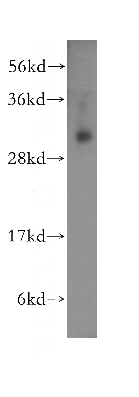K-562 cells were subjected to SDS PAGE followed by western blot with Catalog No:114950(RYBP antibody) at dilution of 1:500