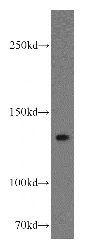 A431 cells were subjected to SDS PAGE followed by western blot with Catalog No:112271(LAMC2 antibody) at dilution of 1:500