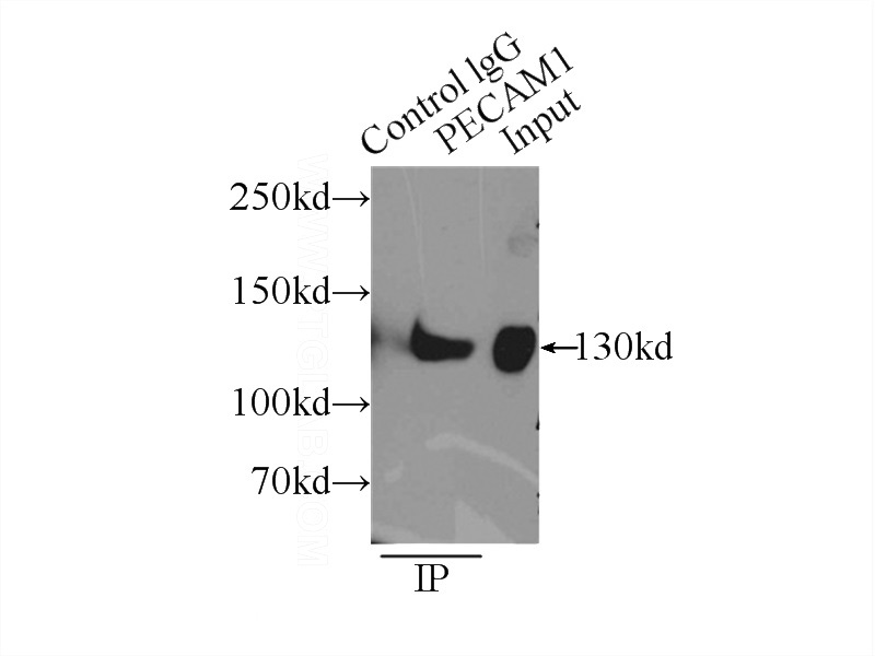 IP Result of anti-PECAM1,CD31 (IP:Catalog No:109025, 5ug; Detection:Catalog No:109025 1:300) with Jurkat cells lysate 4000ug.