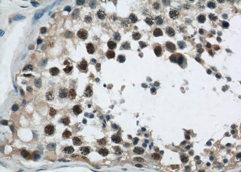 Immunohistochemical of paraffin-embedded human testis using Catalog No:110517(FANCD2 antibody) at dilution of 1:50 (under 40x lens)