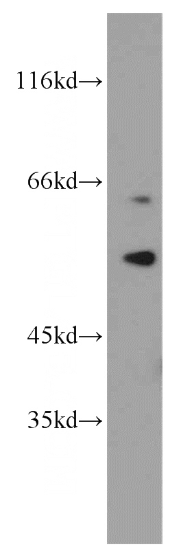 MCF7 cells were subjected to SDS PAGE followed by western blot with Catalog No:115036(RPS6KB2 antibody) at dilution of 1:1500