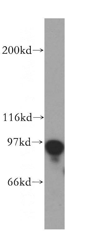 mouse testis tissue were subjected to SDS PAGE followed by western blot with Catalog No:114003(POLI antibody) at dilution of 1:800
