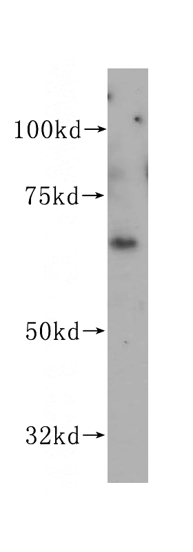BxPC-3 cells were subjected to SDS PAGE followed by western blot with Catalog No:116711(VANGL1 antibody) at dilution of 1:300
