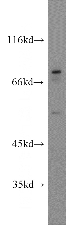 HeLa cells were subjected to SDS PAGE followed by western blot with Catalog No:112107(KLHL4 antibody) at dilution of 1:600