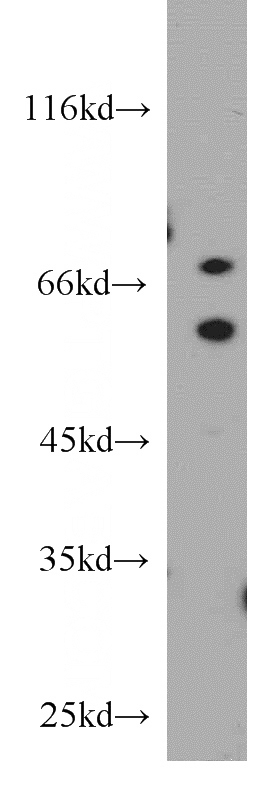 COLO 320 cells were subjected to SDS PAGE followed by western blot with Catalog No:110168(EBF3 antibody) at dilution of 1:500