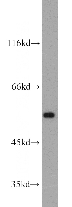 HepG2 cells were subjected to SDS PAGE followed by western blot with Catalog No:112750(MPP6 antibody) at dilution of 1:300