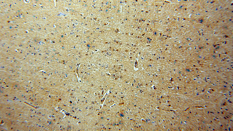 Immunohistochemical of paraffin-embedded human brain using Catalog No:115467(SNUPN antibody) at dilution of 1:100 (under 10x lens)