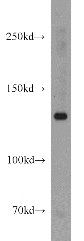 K-562 cells were subjected to SDS PAGE followed by western blot with Catalog No:113275(NRD1 antibody) at dilution of 1:800