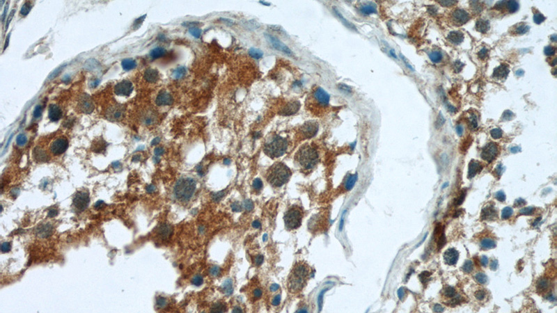 Immunohistochemistry of paraffin-embedded human testis tissue slide using Catalog No:108960(CCDC105 Antibody) at dilution of 1:50 (under 40x lens)