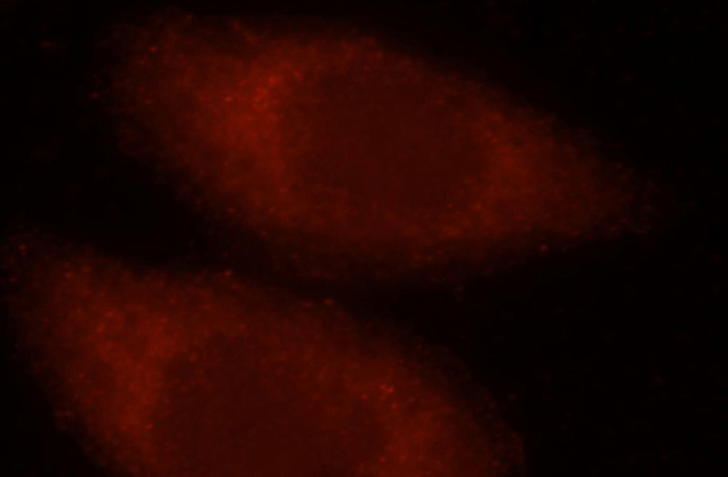 Immunofluorescent analysis of Hela cells, using Myh9 antibody Catalog No:112938 at 1:25 dilution and Rhodamine-labeled goat anti-rabbit IgG (red).