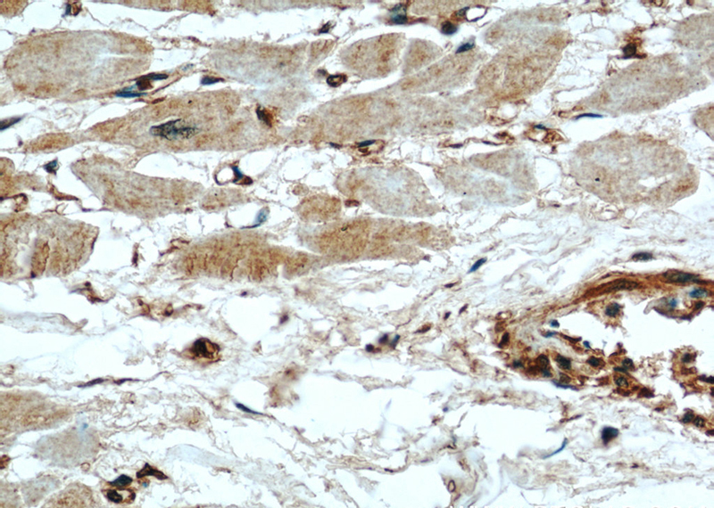Immunohistochemical of paraffin-embedded human heart using Catalog No:112447(MARCKS antibody) at dilution of 1:50 (under 40x lens)