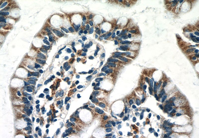 Immunohistochemistry of paraffin-embedded human small intestine tissue slide using Catalog No:107320(NAPRT1 Antibody) at dilution of 1:50 (under 40x lens)