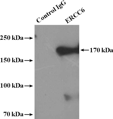 IP Result of anti-ERCC6 (IP:Catalog No:110352, 4ug; Detection:Catalog No:110352 1:300) with HeLa cells lysate 3200ug.