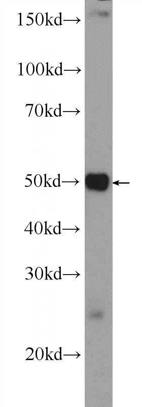 mouse liver tissue were subjected to SDS PAGE followed by western blot with Catalog No:115004(SCML4 Antibody) at dilution of 1:600