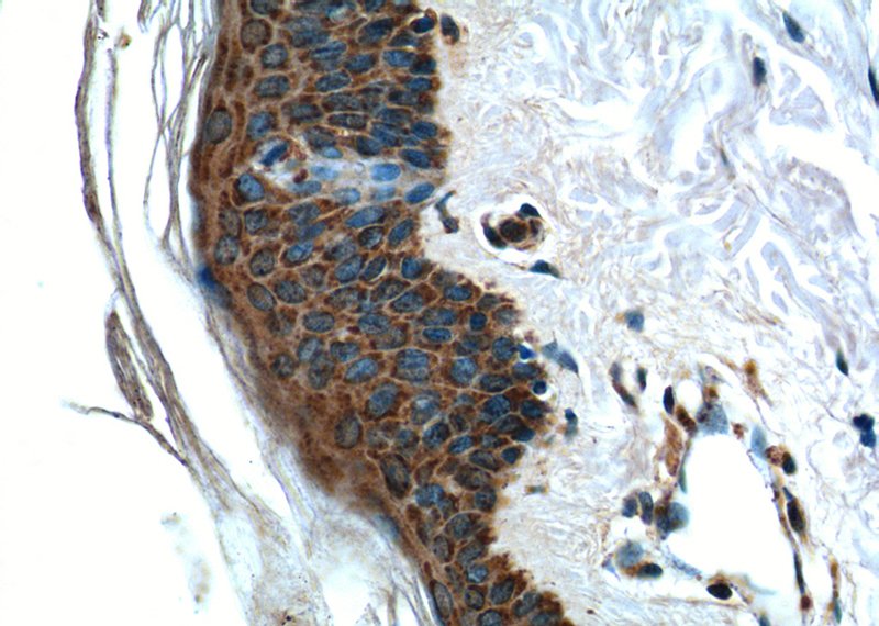 Immunohistochemistry of paraffin-embedded human skin tissue slide using Catalog No:108779(C6orf15 Antibody) at dilution of 1:50 (under 40x lens)